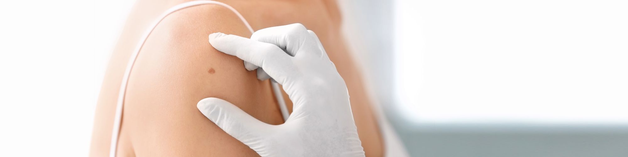 A gloved hand is gently touching a person's upper arm, indicating the process of administering a vaccine or injection. The focus is on the arm, with a clear view of the skin and the hand's position.