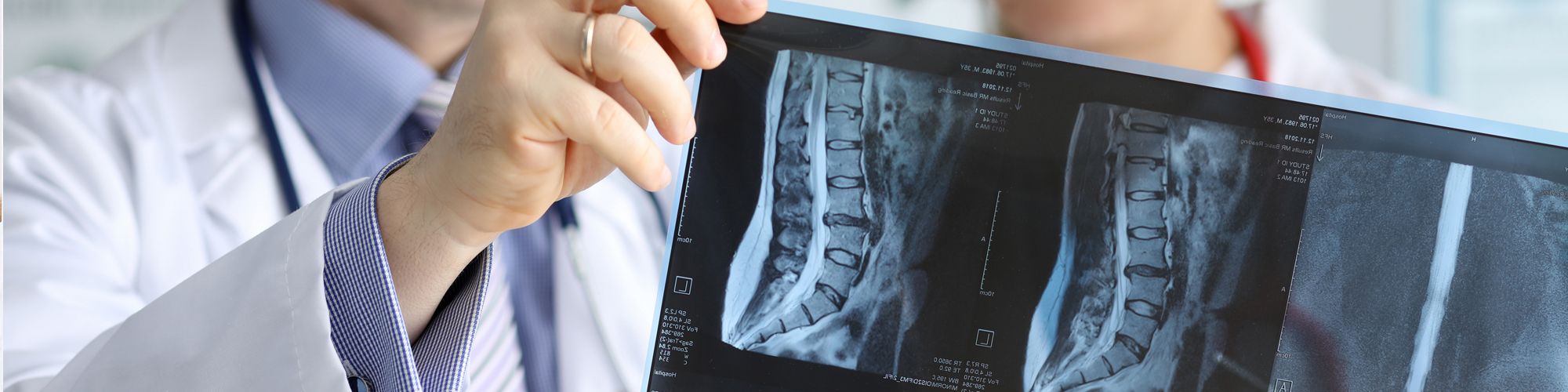 A doctor is examining an X-ray of a spine, holding the image up for review. Another healthcare professional observes in the background. The focus is on the X-ray details indicating possible medical assessment.