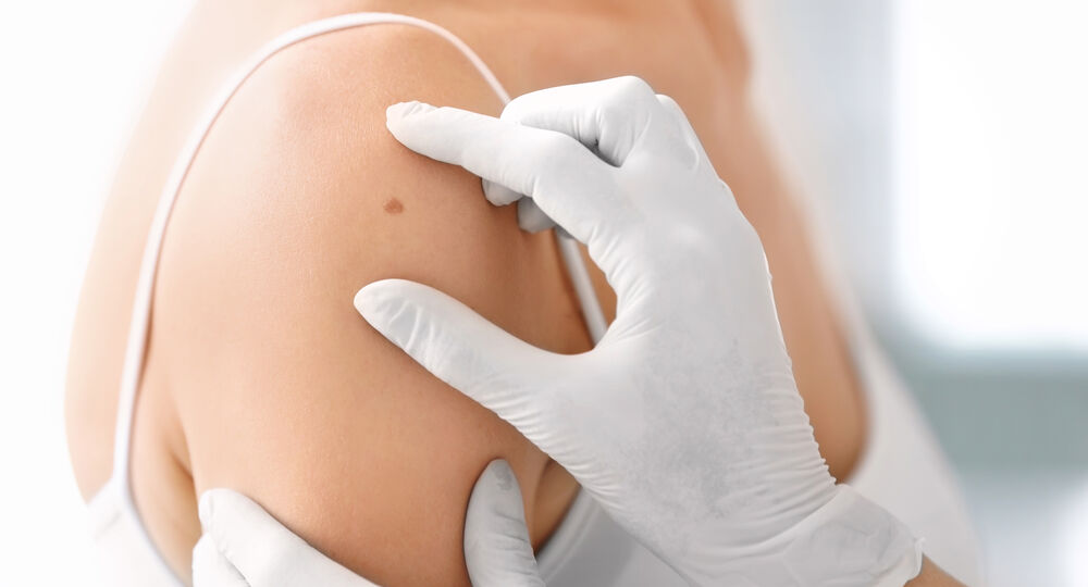 Dermatologische Untersuchung eines Muttermals im Rahmen der Hautkrebsvorsorge und Allergiediagnostik