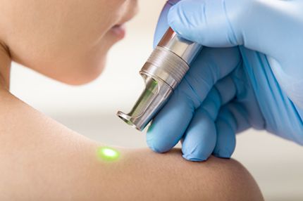 A medical professional wearing blue gloves uses a handheld laser device on a person's shoulder, where a green light is focused. The setting suggests a skincare or medical procedure involving laser treatment.