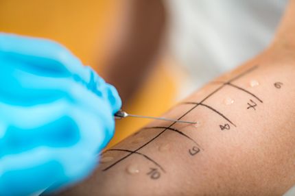 A close-up of an arm with numbered marks ranging from 1 to 10. A gloved hand holds a needle poised above the skin, indicating a skin test or allergy test procedure. Drops of liquid are placed on the marked areas on the skin.