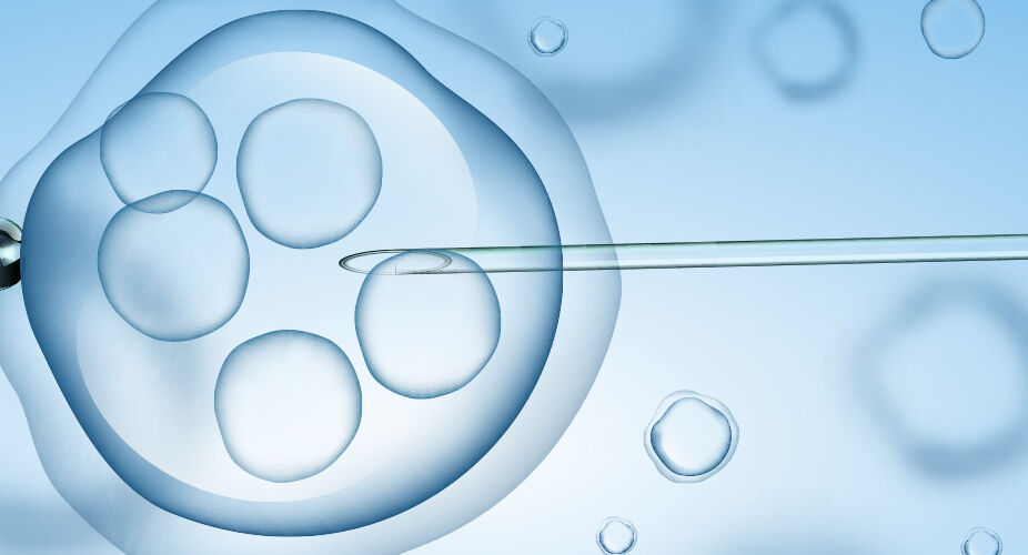 Gynäkologische Endokrinologie und Reproduktionsmedizin Das Bild zeigt eine Darstellung eines Mikropipette, die eine Zelle anvisiert. Im Hintergrund sind mehrere Zellen sichtbar. Es vermittelt den Eindruck von Forschung im Bereich der Biologie oder Reproduktionsmedizin.