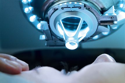 A close-up view of a patient lying on an examination table, with a medical device positioned above their face. The device, illuminated with blue lights, appears to be part of an eye examination or surgical procedure. The patient's eyes are closed, and their hand rests near their face.