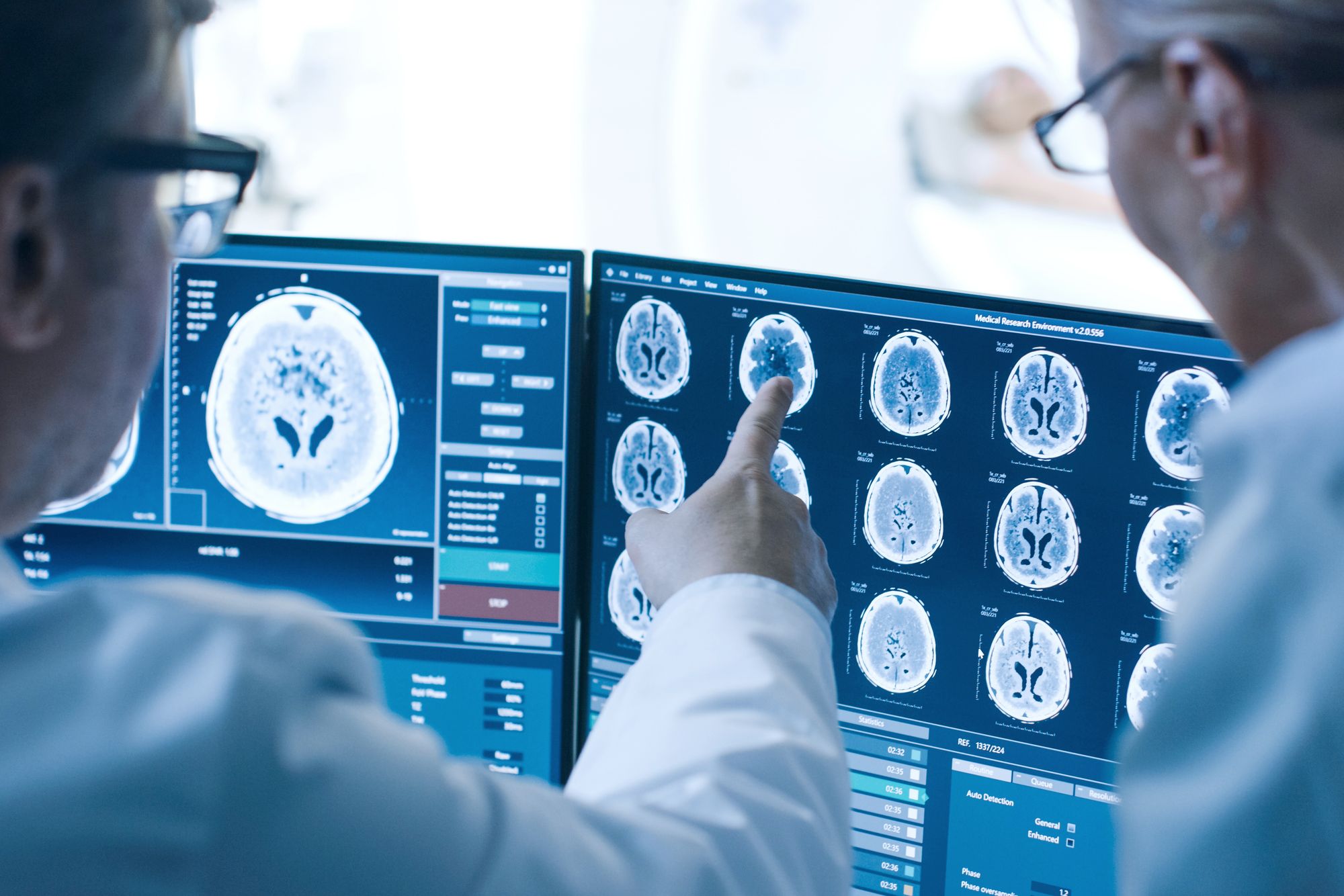 Two medical professionals examine computer screens displaying brain scans. One person is pointing at a specific scan, highlighting a feature for discussion. The screens contain various images and data related to brain imaging.