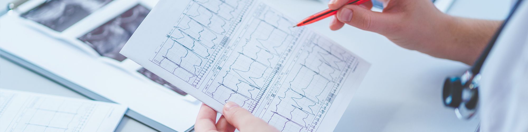 A person is holding a sheet of paper displaying multiple electrocardiogram (ECG) graphs. They are using a red pen to point out details on the graphs while seated at a desk with additional medical papers nearby.
