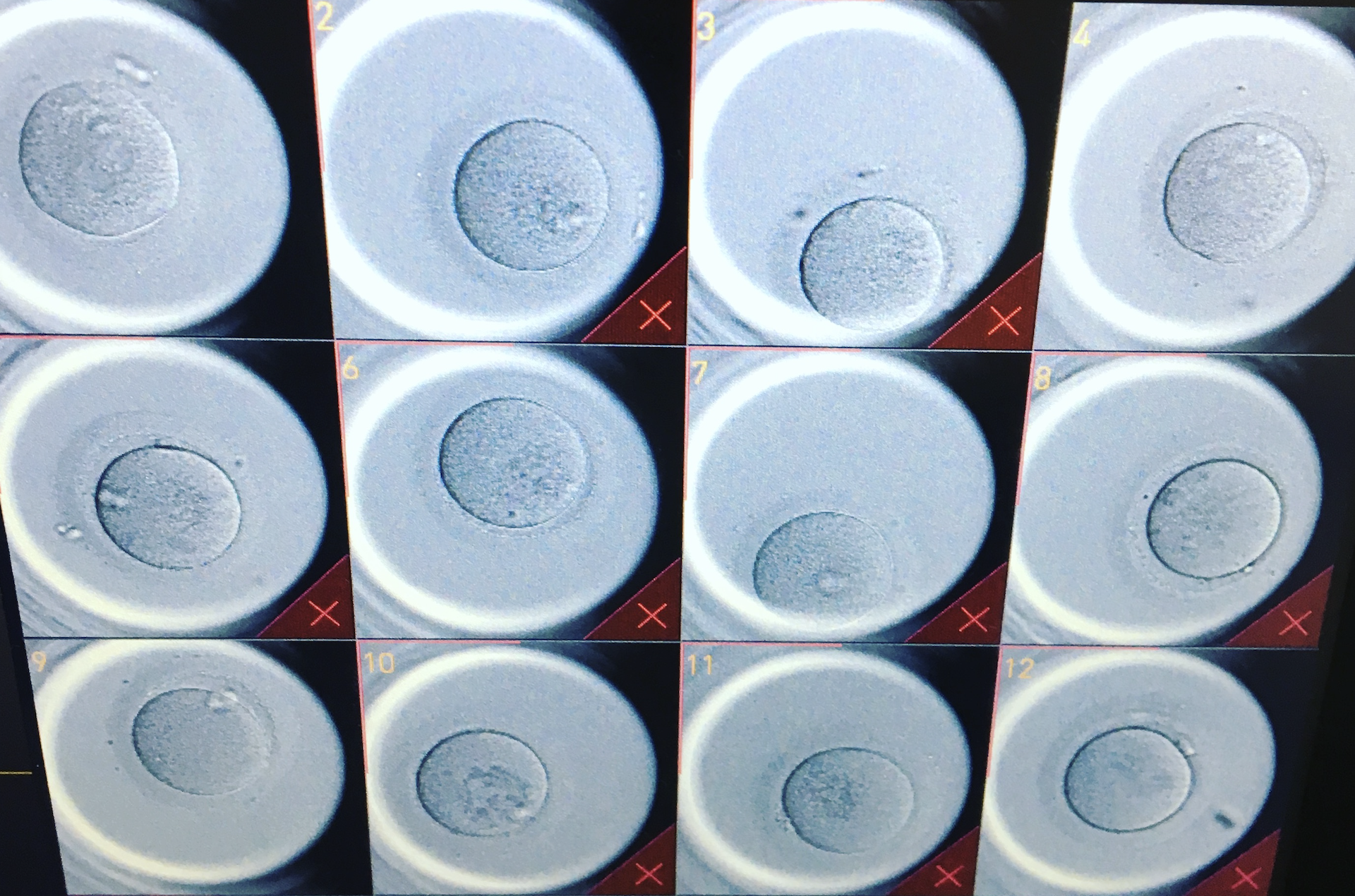 Eine Reihe von zwölf runden, flachen Objekten wird in einer 3x4-Anordnung gezeigt. Jedes Objekt hat eine zentrale Vertiefung und zeigt unterschiedliche Texturen oder Oberflächenmerkmale. Einige sind klar, während andere kleine Unregelmäßigkeiten aufweisen.