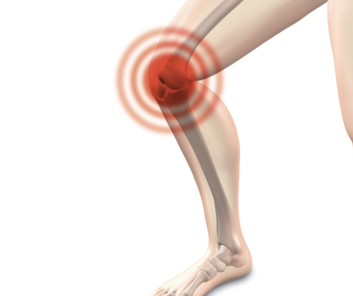 Das Bild zeigt ein menschliches Bein mit einem Fokus auf das Knie. Um das Knie herum sind rote Wellen oder Schwingungen dargestellt, die auf Schmerzen oder Beschwerden hinweisen.